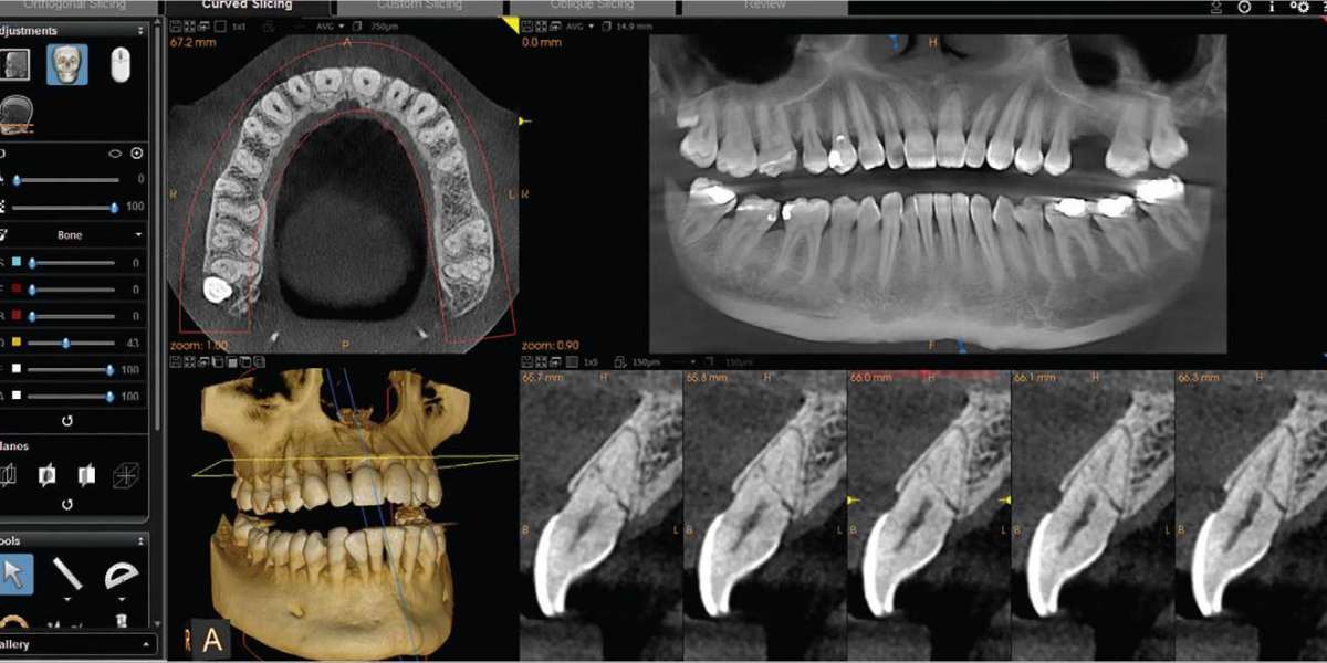 CBCT Dental Imaging Market Outlook Report includes Global Industry Size & Forecasts