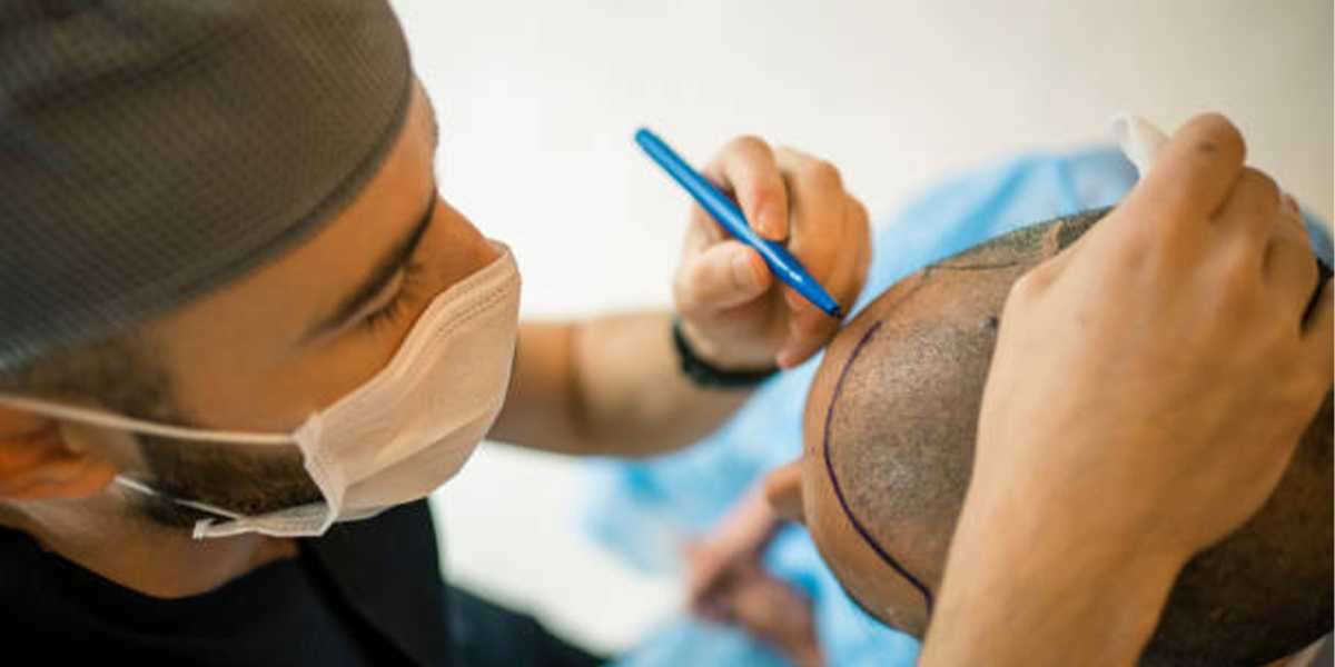 Unveiling the Secrets of PRP Hair Treatment and FUE Hair Transplant in Jeddah