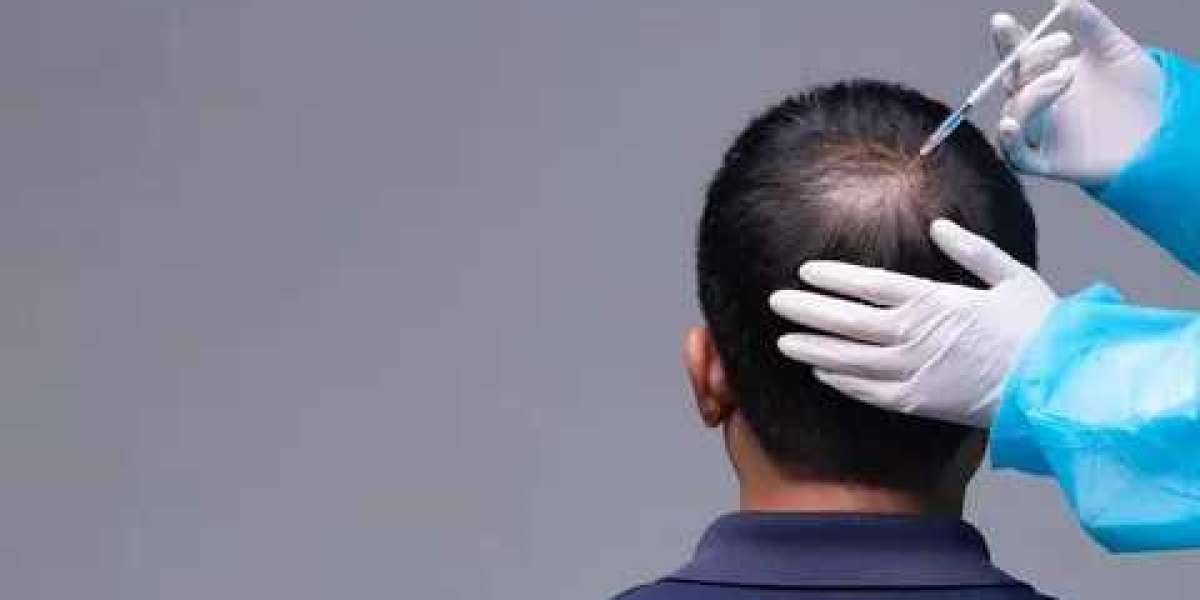 The Future of Hair Restoration: PRP Treatment in Riyadh